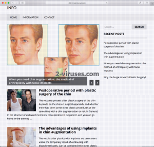 Chinimplants.website Virus